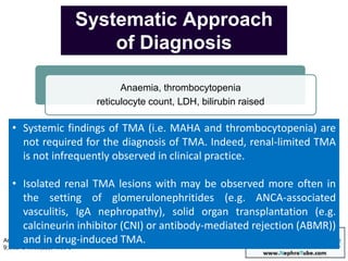 tma drug
